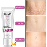 Pregnancy Leave and Skin Crack Repairing Firming Cream
