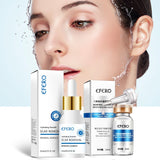 Hyaluronic Extract for Anti-Wrinkle Aging Face cream